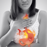 Home Remedies For Acid Reflux