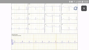 SmartHeart Pro Screenshot 3