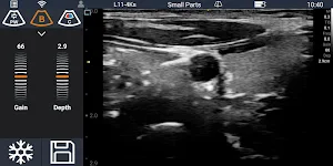 Youkey SonoiQ - Wireless Pocket Ultrasound System Screenshot 3