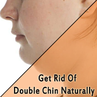 Get Rid Of Double Chin Natural