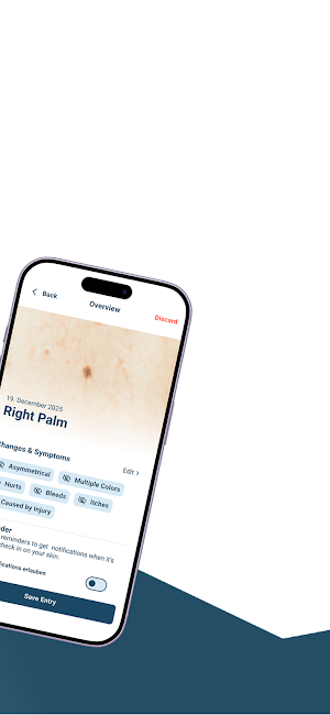 SkinAware Screenshot 1
