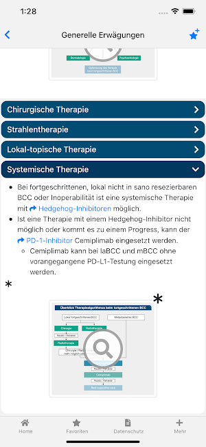 Basalzellkarzinom onkowissen Screenshot 2