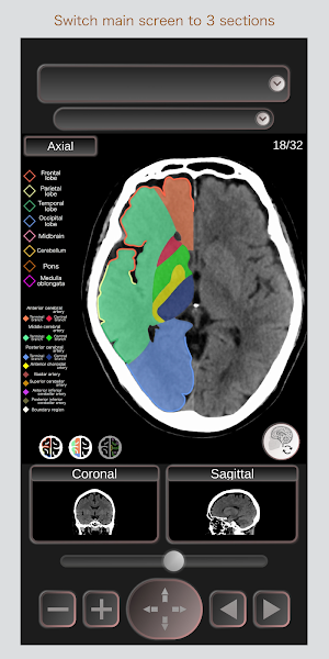 CT Passport Head/Brain / sectional anatomy / MRI Screenshot 3