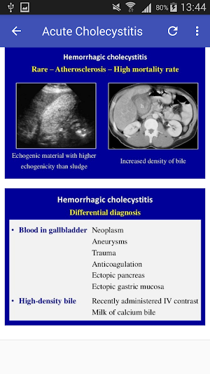 Ultrasound Of Gallbladder Screenshot 1