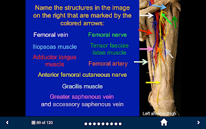 MSK Anatomy - SecondLook Screenshot 2