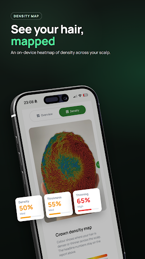 Trichometrics: Hair Loss AI Screenshot 0