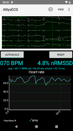 AttysECG Screenshot 0