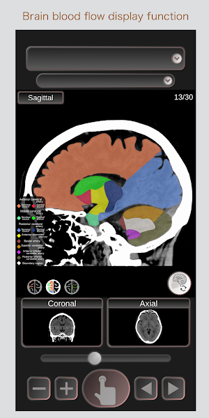 CT Passport Head/Brain / sectional anatomy / MRI Screenshot 2
