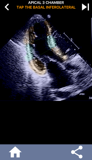 AHA 17 SEGMENT INTERACTIVE HEART QUIZ Screenshot 3