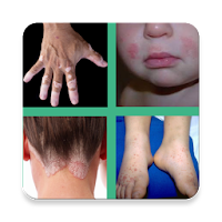 All Skin Diseases and Treatments - Skin care guide