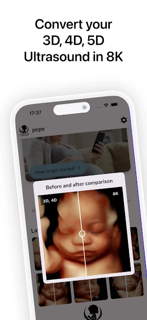 LittleLife 3D 4D Ultrasound 8K Screenshot 0
