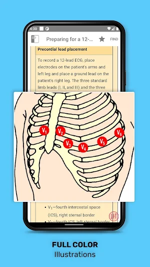 ECG Interpretation: Pkt Guide Screenshot 2