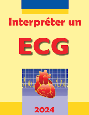 Interpreter un ECG Screenshot 0