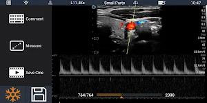 Youkey SonoiQ - Wireless Pocket Ultrasound System Screenshot 0