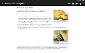 WikiMed - Wikipedia Medizin (Offline) Screenshot 3