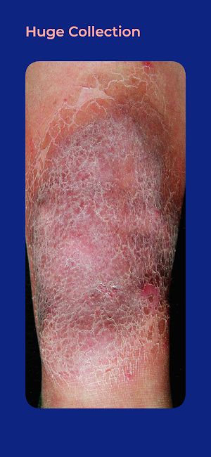 Skin Care Diseases & Treatment Screenshot 0