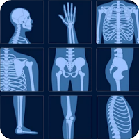 X-Ray Interpretation Guide