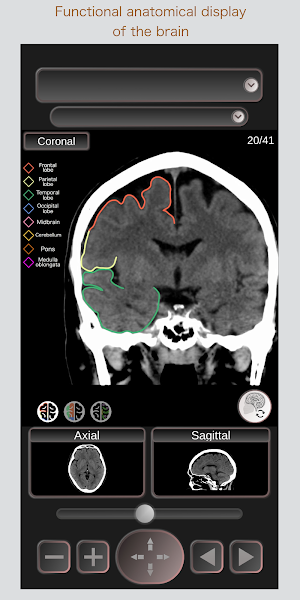 CT Passport Head/Brain / sectional anatomy / MRI Screenshot 1