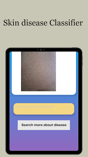 MyDerma Checker Screenshot 3