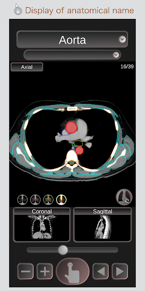 CT Passport Chest / sectional anatomy / MRI Screenshot 0