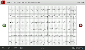 JS SportsECG Screenshot 1