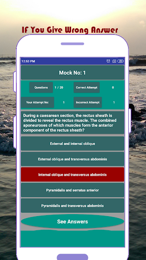 Gynae & Obs MCQ Question Screenshot 3