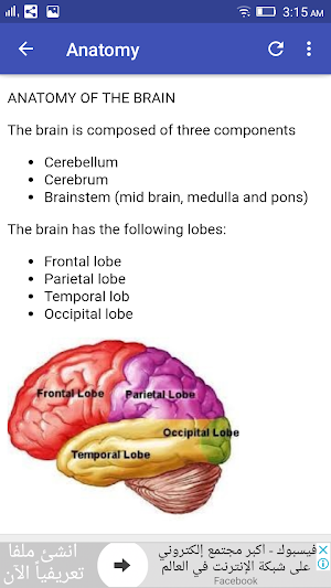 Stroke In CT Screenshot 2