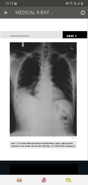 Medical X-RAY Interpretations with over 120+ cases Screenshot 3