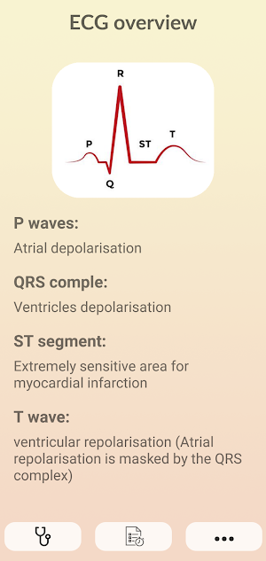 ECG Guide - Master Electrocardiogram Reading Screenshot 3