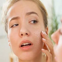 Dry skin treatment in summer