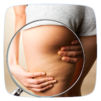 How to Get Rid of Cellulite