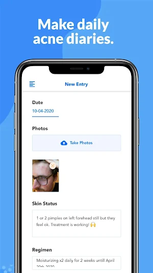 SkinTheory: Skin + Acne Tracker Screenshot 2