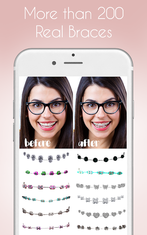 Braces Photo Editor Screenshot 0