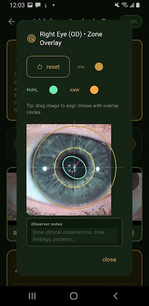 Iridology Analysis Toolkit Pro Screenshot 2