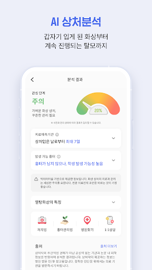 상처닥 - 화상,아토피,상처,흉터에 대한 셀프피부관리 Screenshot 2