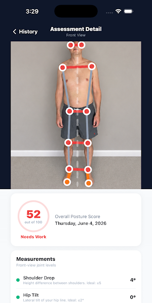 Posture Guy - Fix Your Posture Screenshot 2