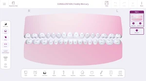 OsstellConnect Screenshot 1