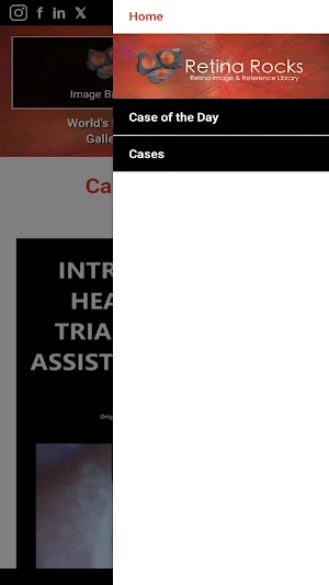 Retina Rocks Screenshot 1