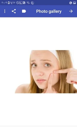 Facial acne treatment Screenshot 0