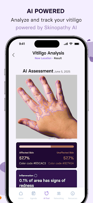 Skinopathy Vitiligo Screenshot 0