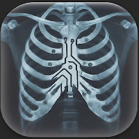X-Ray Scanner