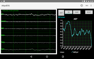 AttysEEG Screenshot 3