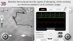 AngioAID 3D Screenshot 1