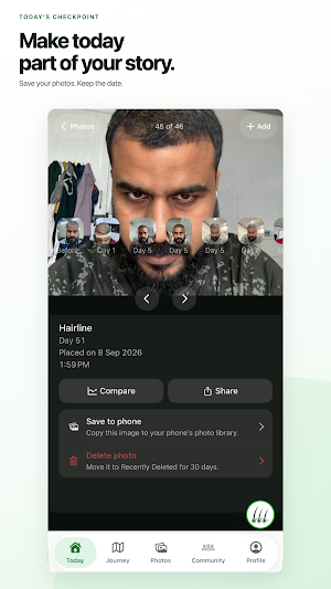 Regrow: Hair Transplant Care Screenshot 3
