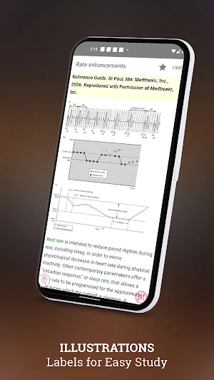 Cardiac Pacing and ICDs Screenshot 2