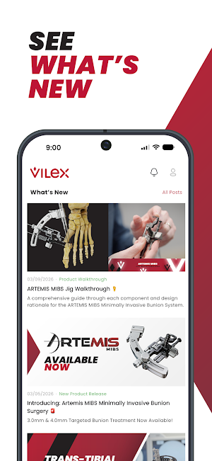 Vilex Screenshot 0