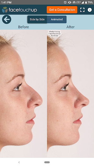 FaceTouchUp Nose Job Simulator Screenshot 2