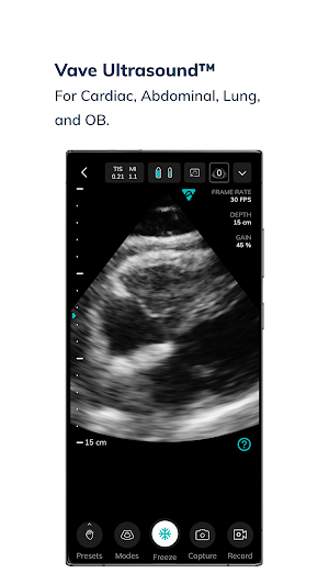 Vave Wireless Ultrasound Screenshot 2