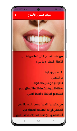 وصفات تبيض ولمعان الاسنان مجرب Screenshot 3
