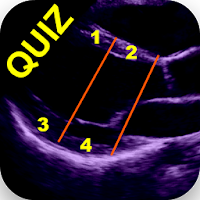 AHA 17 SEGMENT INTERACTIVE HEA